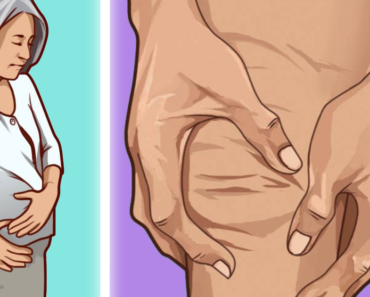 +5 Common Early Symptoms of Arthritis